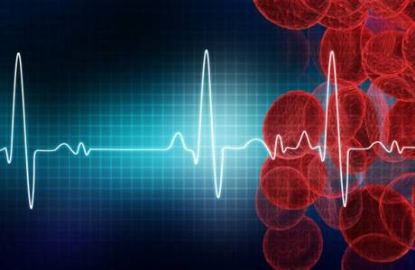 Síndrome de repolarização precoce