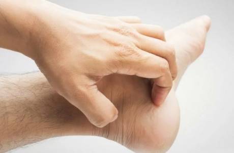 Signos de hongos en los pies