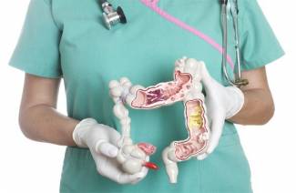 Sintomas de pólipos nos intestinos
