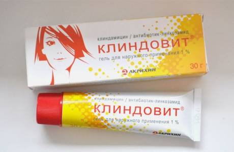 Akné antibiotiká