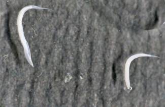 Medicína pinworm