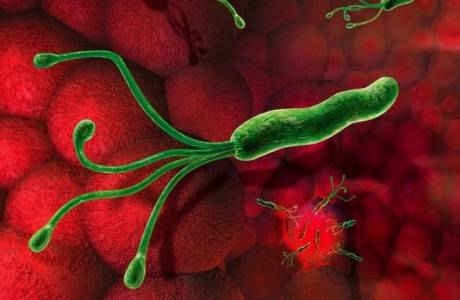Klebsiella v moči