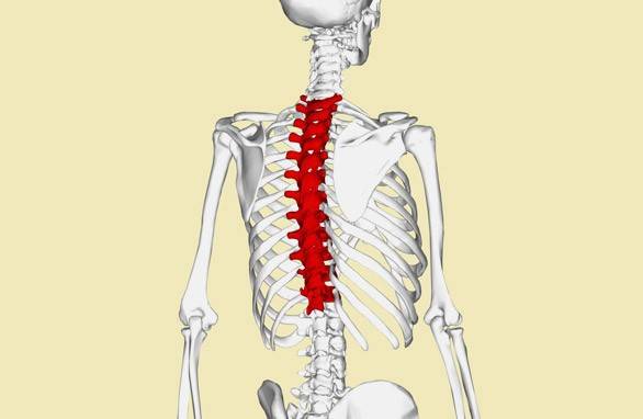Neuralgia Torácica