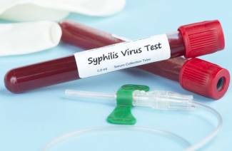 Syfilisov test