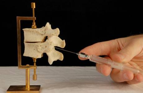 Bloqueo en la osteocondrosis
