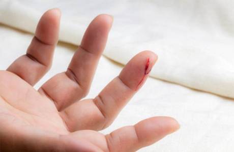 Ungüento de curación de heridas