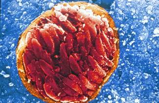 Infecções por protozoários