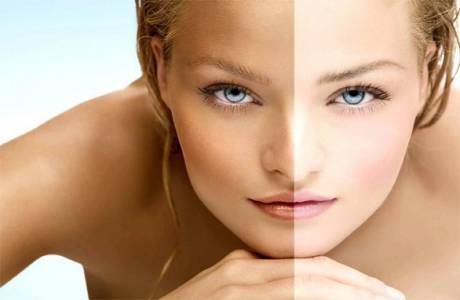 Domov Whitening
