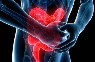 Síntomas de colitis ulcerosa.
