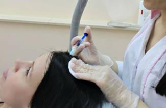 Mezoterapia pre vlasy