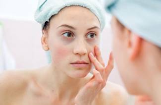 Círculos debajo de los ojos: las causas de la enfermedad en las mujeres