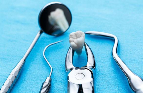 Extração do dente do siso