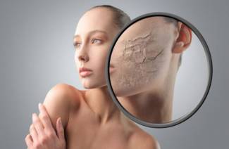 Atopická dermatitída u dospelých