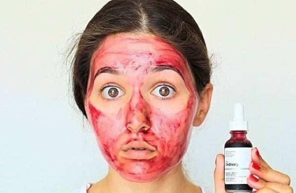 Peeling Ácido
