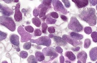 Mycoplasma genitalia