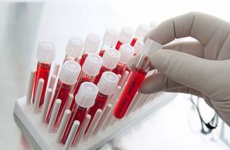 Hemoglobin oranı