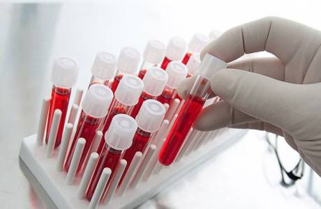 Hemoglobin oranı