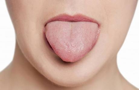leukoplakia
