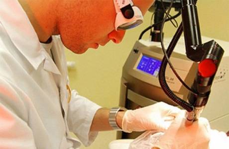 Tratamento a laser para hemorróidas