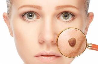 Moles são perigosos e não perigosos