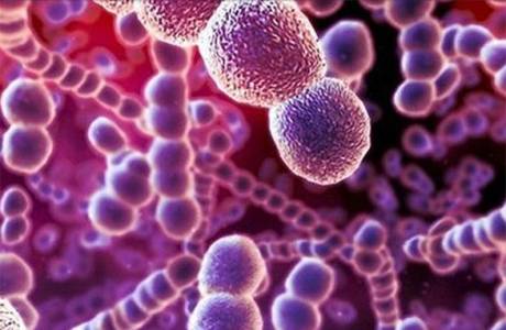 Infección estreptocócica