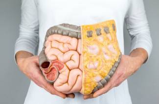 Doença de Crohn