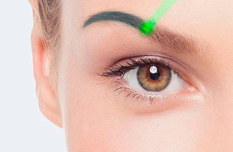 Remoção de tatuagem de sobrancelha a laser