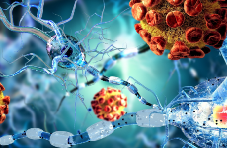 Infecção bacteriana