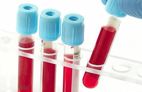 Causas do aumento da creatinina no sangue