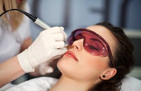 Biorevitalización con láser