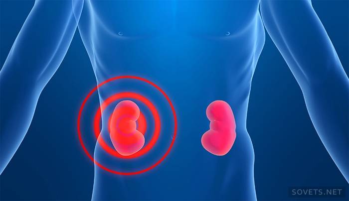 insuficiencia renal humana