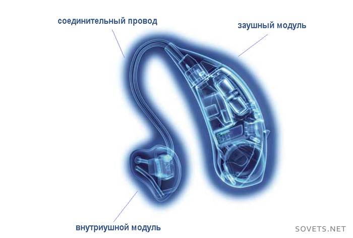 Technologie i cechy aparatu słuchowego
