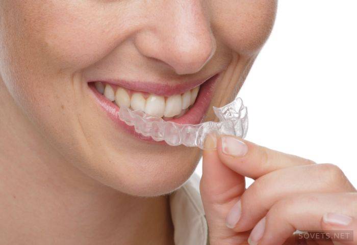 clareamento dos dentes