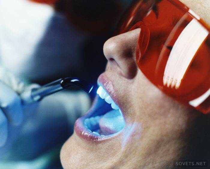 Branqueamento de dentes a laser