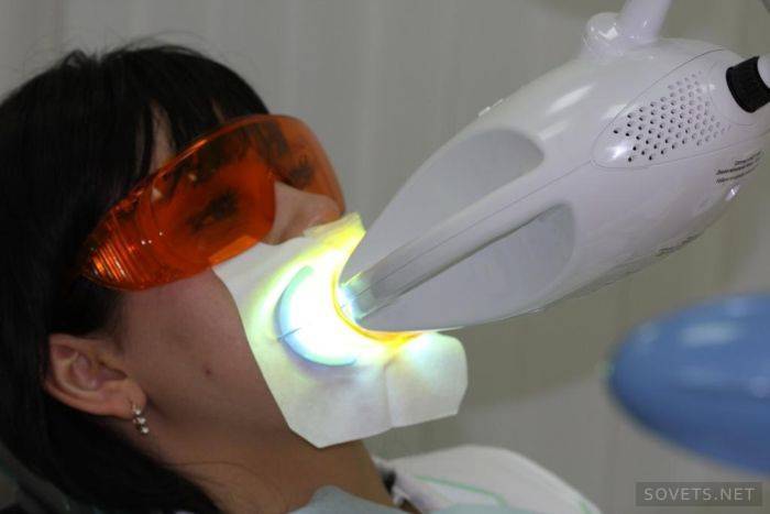 Clareamento dos dentes