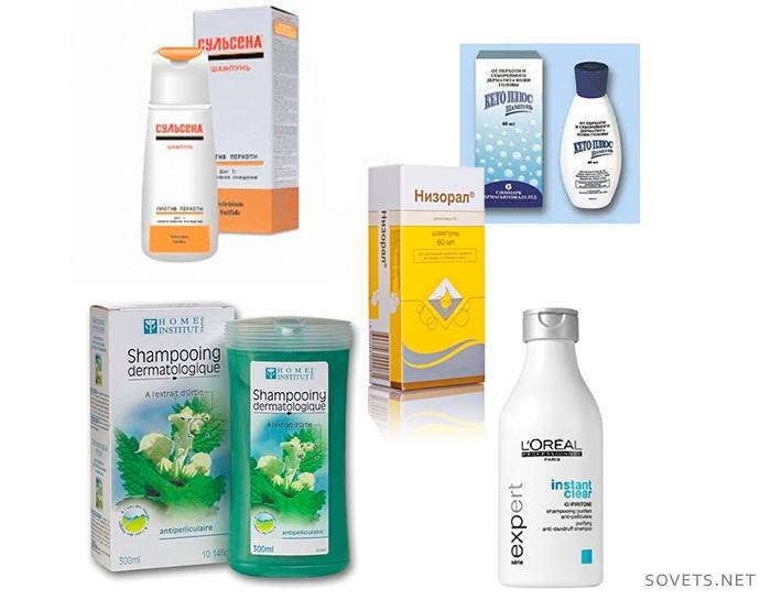 5 melhores remédios caspa