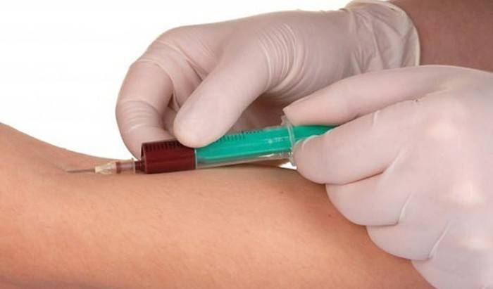 Amostra de sangue