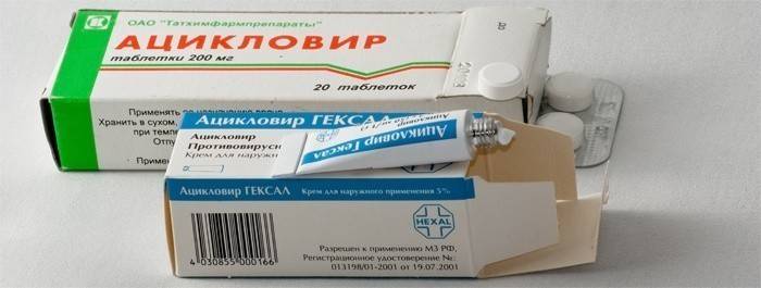Anciclovir para o tratamento do vírus Epstein-Barr