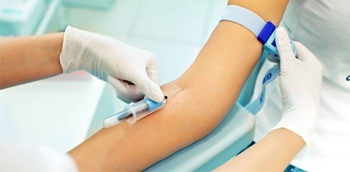 Muestreo de sangre para análisis.