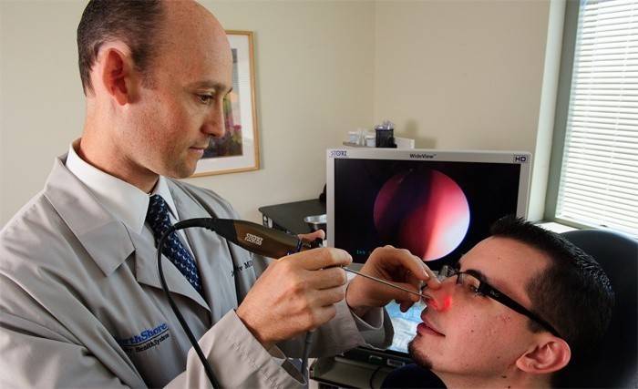 Lekarz diagnozuje grzyb w nosie