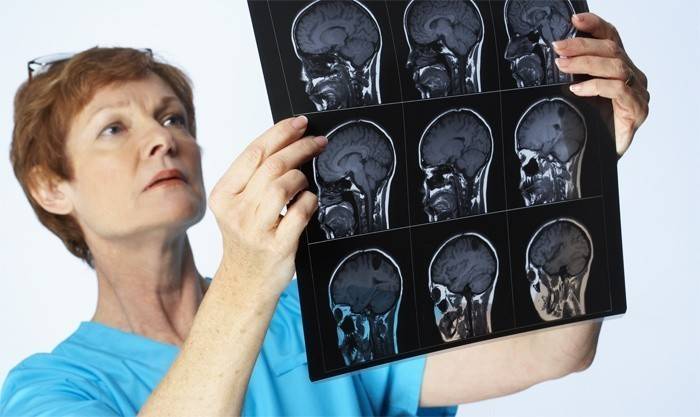 Žena skúma tomogram