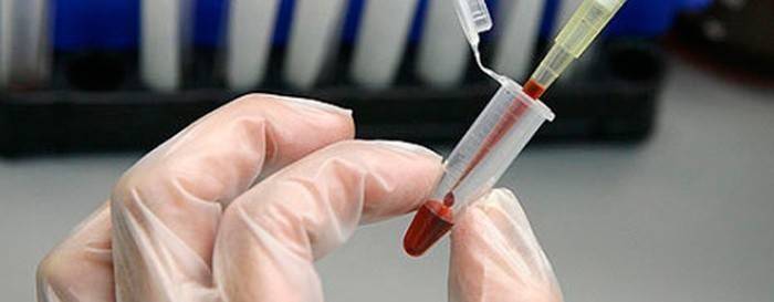 Krvný test na cholesterol