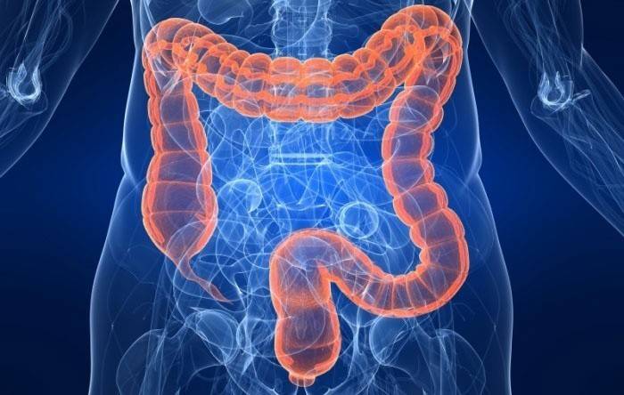Colitis ulcerosa: inflamación del colon.