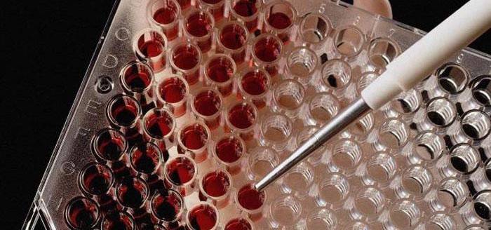Preparando-se para um teste de testosterona no sangue