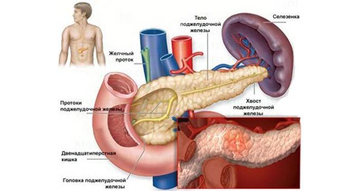Pancreatite crônica