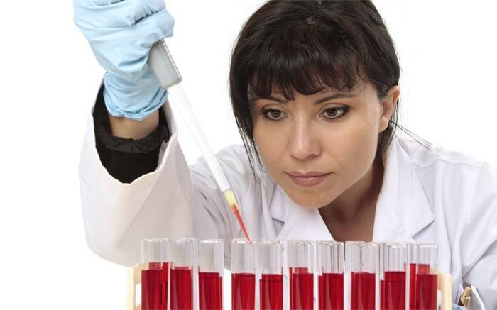 Laboratórny asistent skúma krvné testy