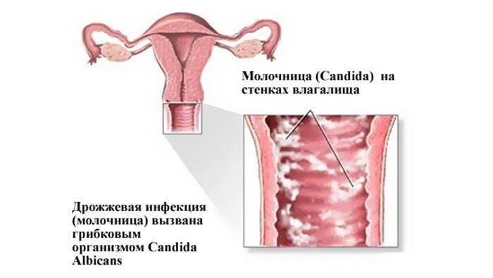 Huba Candida