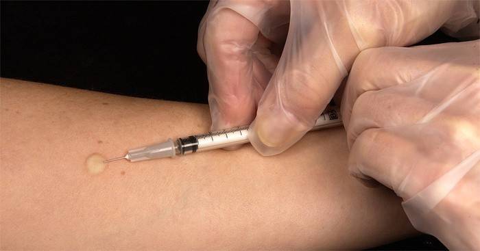 Vacina contra a tuberculose