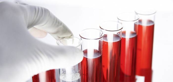 Testes de sangue do vírus Epstein-Barr