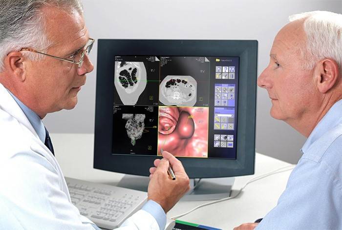 Un médico examina el resultado de una colonoscopia.
